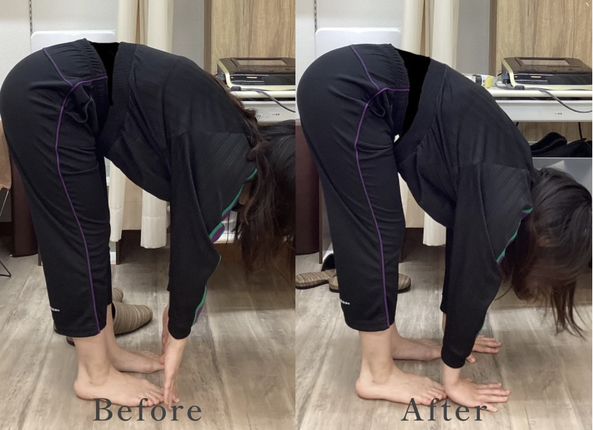 骨盤矯正 | セレネ整骨院鍼灸院 旗の台院